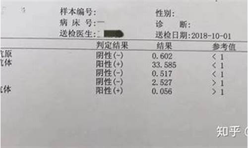 高考体检乙肝2017_高考体检乙肝对大学录取有影响吗